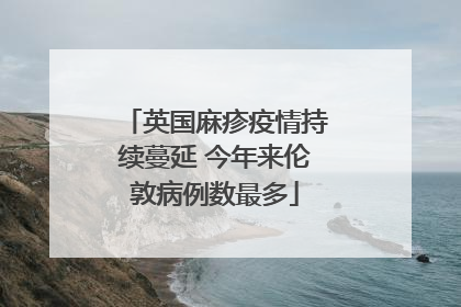 英国麻疹疫情持续蔓延 今年来伦敦病例数最多